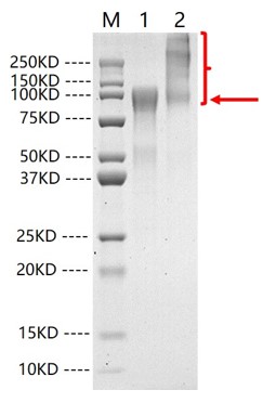 SARS-CoV-2 Spike Protein (S1)